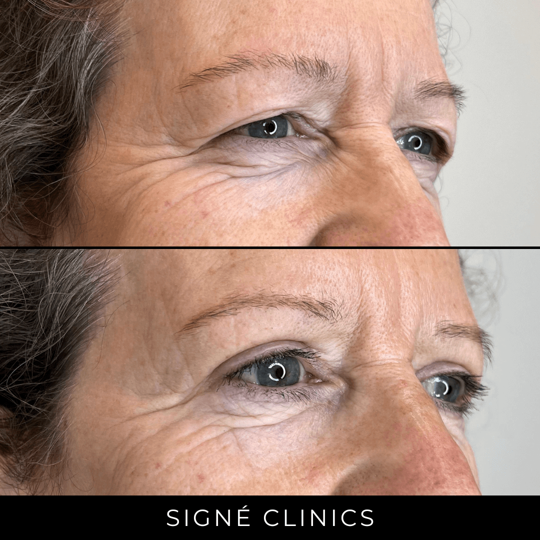 signe clinics